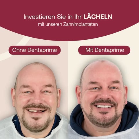 Dentaprime before & after